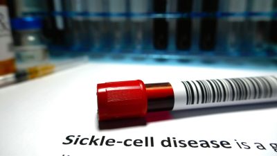 A tube of blood labeled "sickle cell disease".